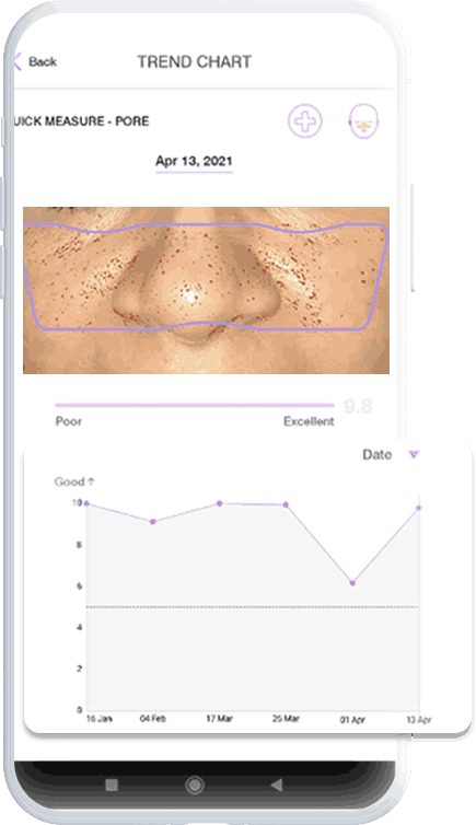 Advanced AI Skin Analysis