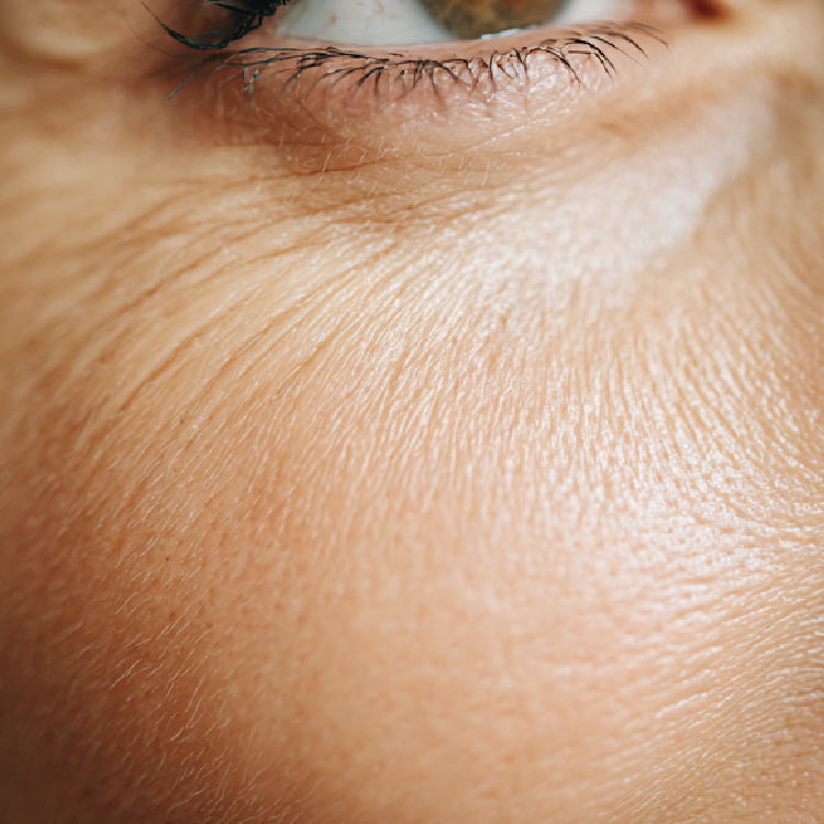 Anti Aging
